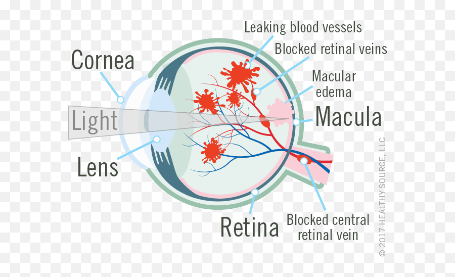 Eye Shows Cornea Lens Macula - Blood Supply To Macula Png,Lens Flare Eyes Png