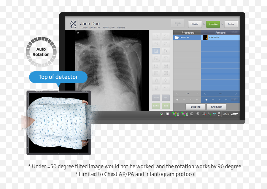 Value - Up Package 2021 Samsung Healthcare Global Png,Auto Rotate Icon