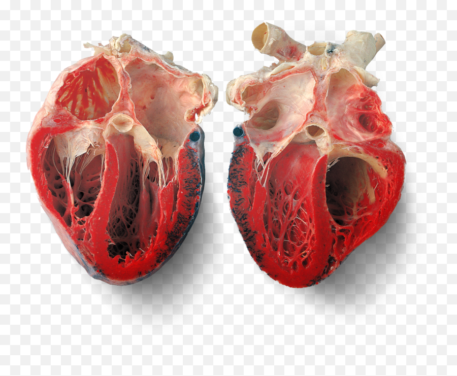 Half Heart Png Transparent - Inside Of A Real Heart,Half Heart Png
