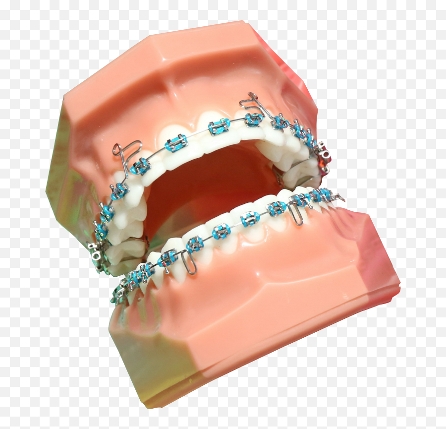 Dentist - Dental Braces Png,Braces Png
