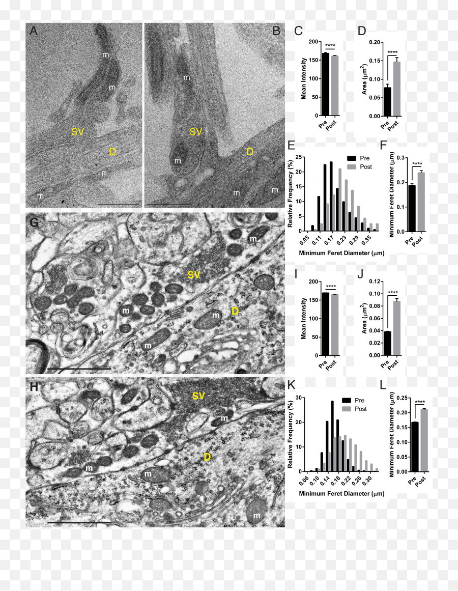 Mitochondria In Hippocampal Presynaptic - Mitochondria In Synapse Electron Microscope Png,Mitochondria Png