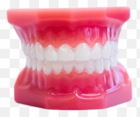 Wow Smiles Quality Orthodontics Braces Invisalign U0026 More - Clear Aligners png