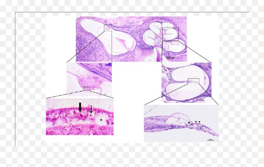 Photomicrograph Of The Left Temporal Bone Thin Arrow U003d Type - Sketch Png,Thin Arrow Png