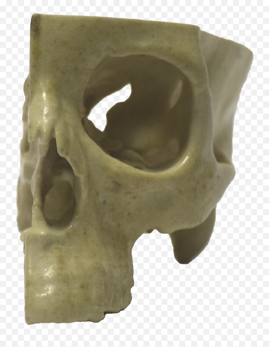 Front Of 3d Printed Half Skull - Skull Png,3d Skull Png