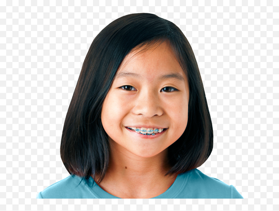 Girl - Kool Smiles Braces Png,Braces Png