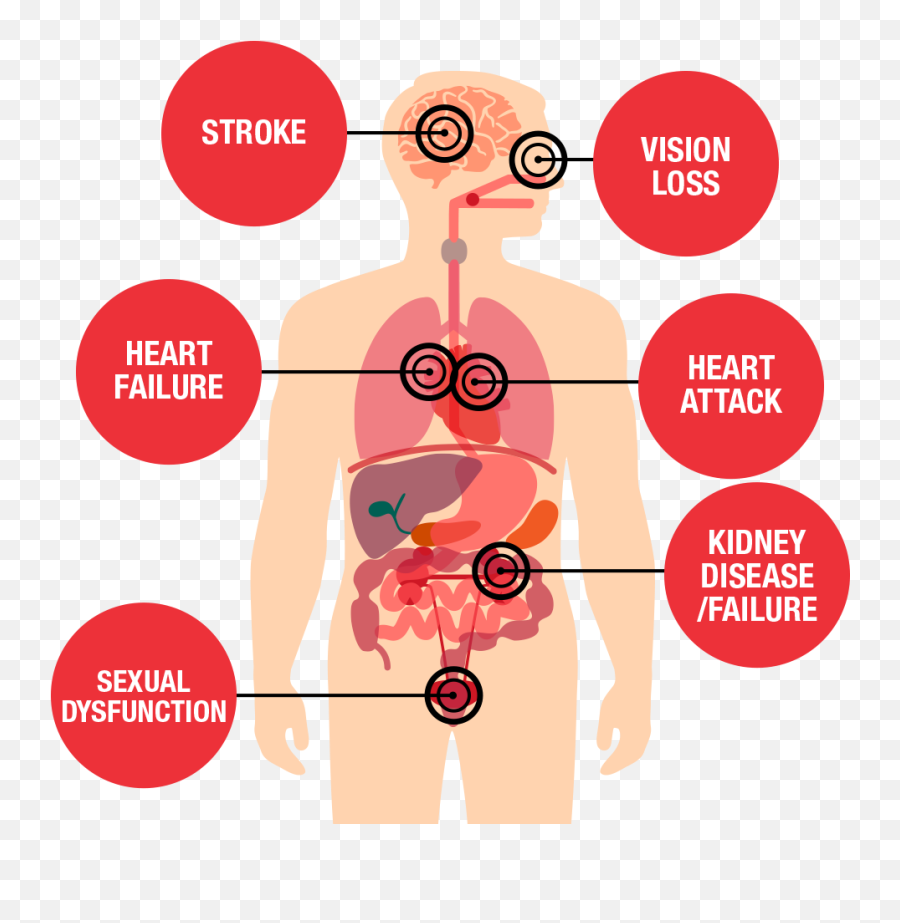 Health Threats From High Blood Pressure - Symptoms Of High Blood Pressure Png,High Blood Pressure Icon