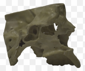 Side Of 3d Printed Half Skull - Skull Png,3d Skull Png