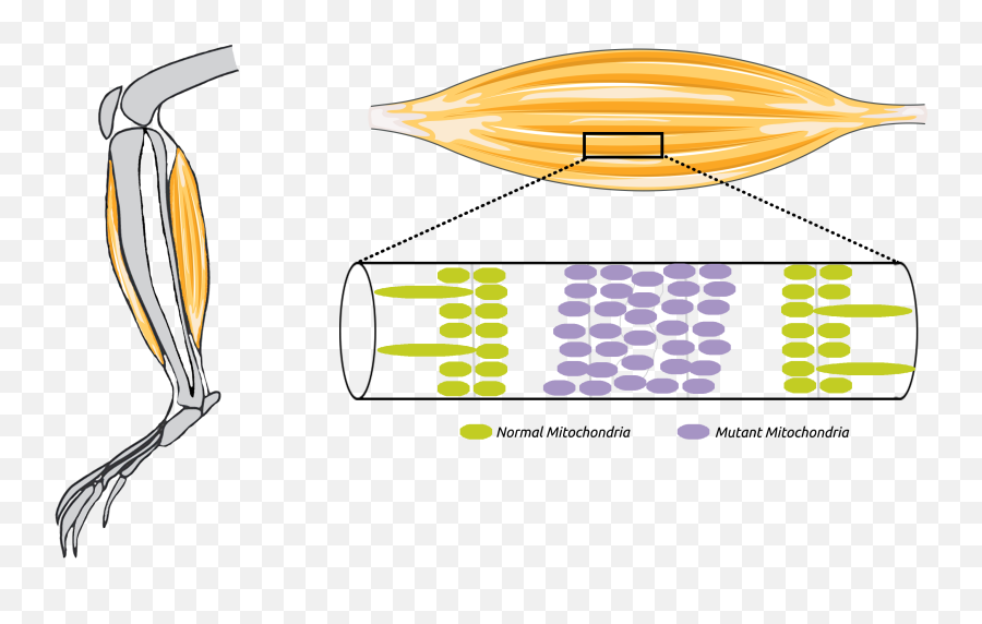 Mitochondrial Myopathies Childrenu0027s Research Institute - Sketch Png,Mitochondria Png