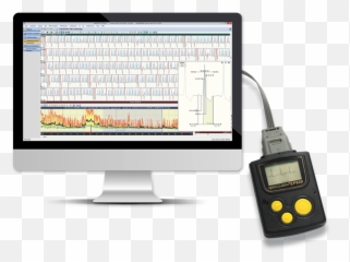 Holter Ecg - hospital AMEDTEC medical technology made in Aue Amedtec png