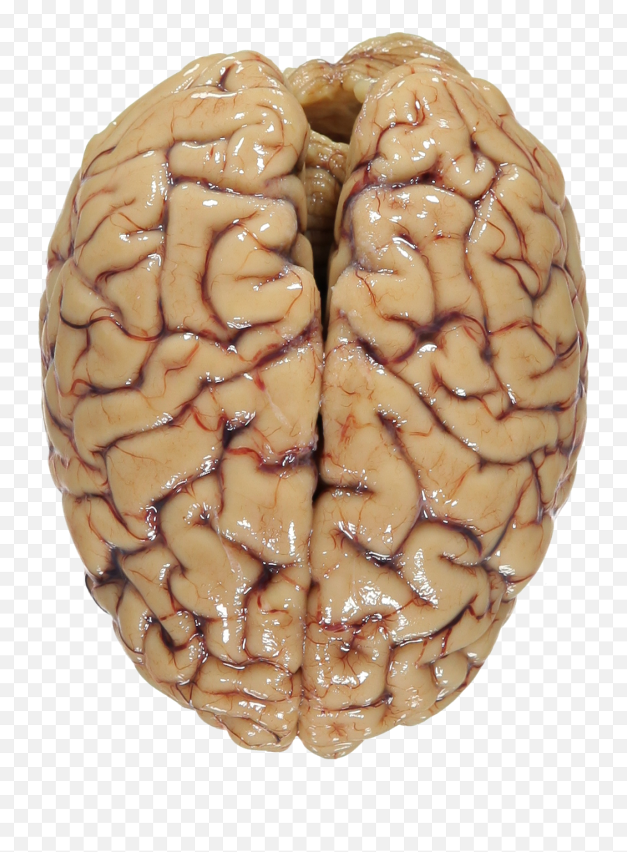 Human Brain Transparent Image - Real Human Brain Png,Human Brain Png