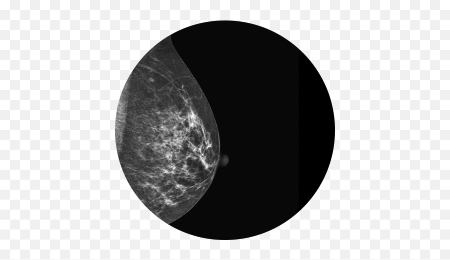 Breast Imaging - Breast Imaging Png,Mammogram Icon