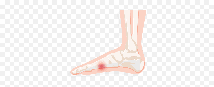 Identifying Your Foot Pain 2020 Treadmillreviewsnet - Pain On Inside Of Foot Png,Feet Transparent