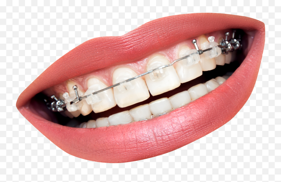 Human Smile Transparent Png Clipart - Transparent Smile Mouth Png,Smiling Mouth Png