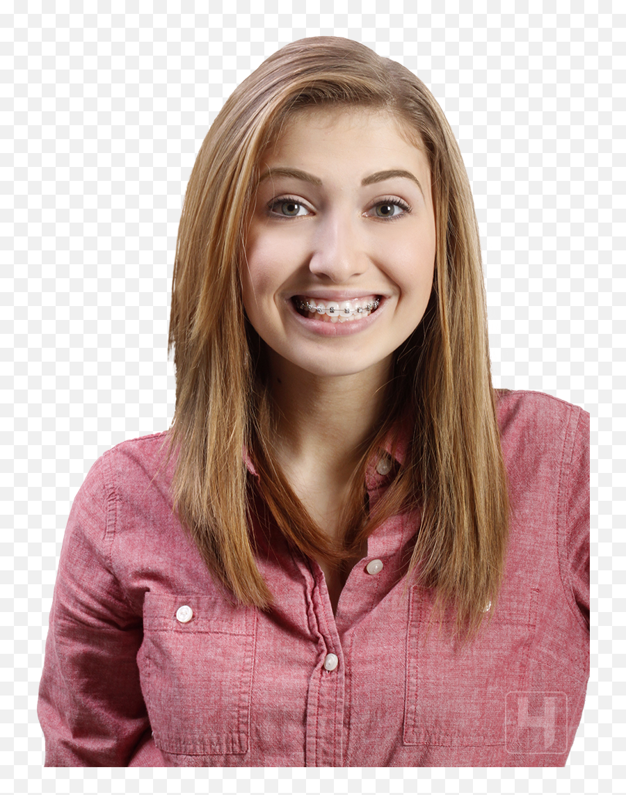 Key Benefits Of Self Ligating Braces - Girl With Braces Png,Braces Png