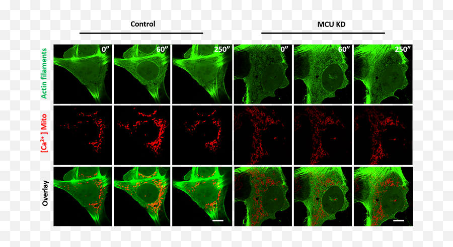 Advancing Knowledge In Mitochondria Division Using Dragonfly - Graphic Design Png,Mitochondria Png