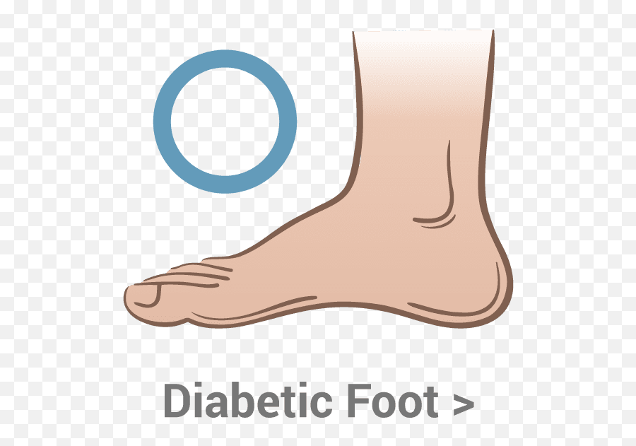 Diabetic Foot - Kassis Brothers Shoes Sock Png,Feet Transparent