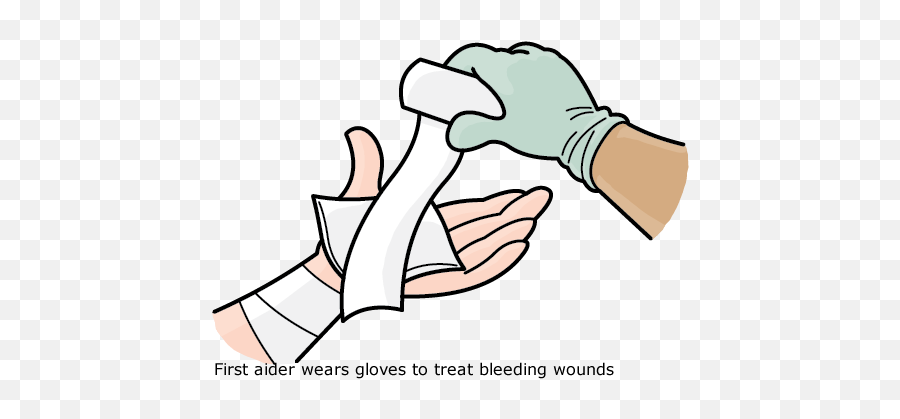 External Bleeding - First Aid For Bleeding 477x338 Png First Aid Clipart For Bleeding,First Aid Png