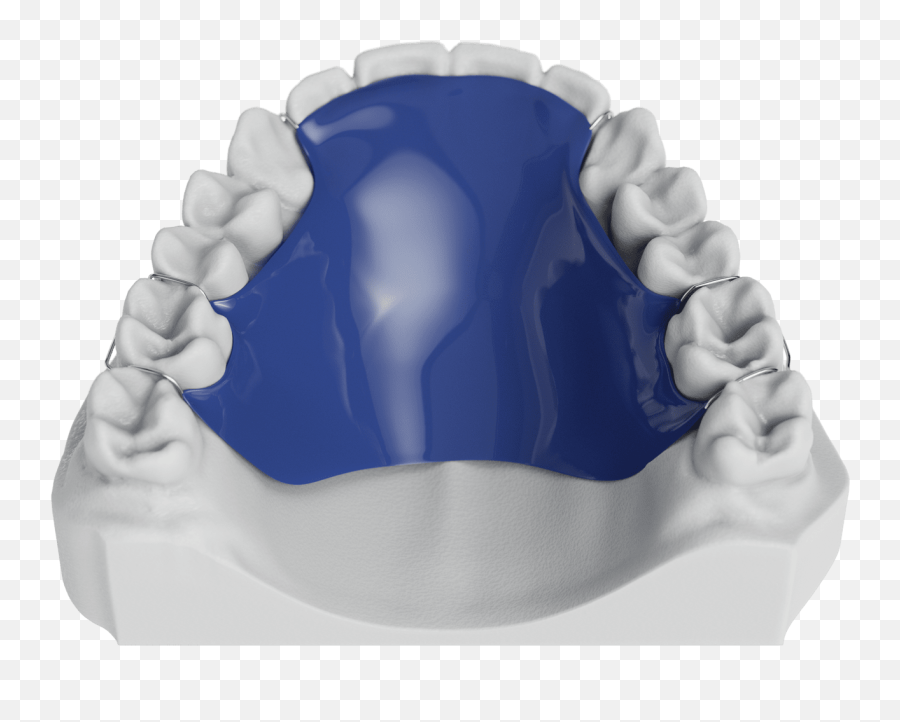 Hawley Phase 1 Retainer Odl Orthodontic Labs - Orthodontic W Arch Appliance Png,Retainer Icon