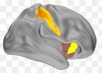 National Institute Of Neurological Disorders And Stroke Png