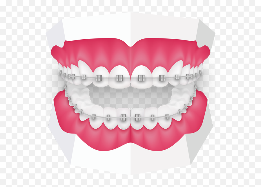 Uk Tooth - Png,Braces Png