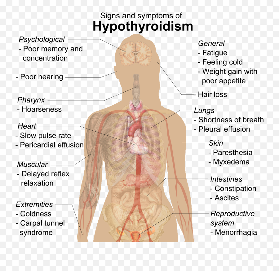 Filesigns And Symptoms Of Hypothyroidismpng - Wikimedia Effect Of Hypothyroidism,Lungs Png
