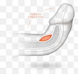 Peyronies Disease Penis - png
