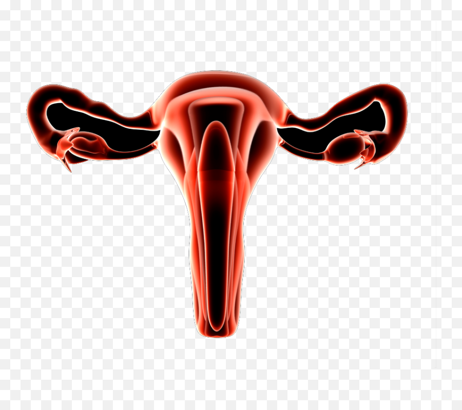 Uterine Fibroids Adenomyosis - Illustration Png,Uterus Png