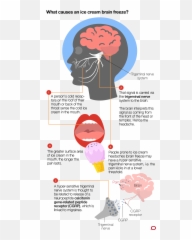 What Causes Brain Freeze - Do We Get Brain Freeze Full Do We Get Brain Freeze Png,Freeze Png