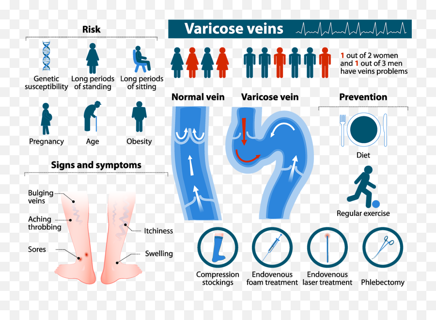 Varicose Veins Dickson Medical Associates - Varicose Vein Treatment Options Png,Veins Png
