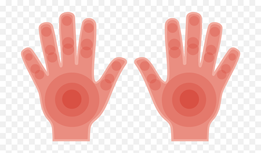 Red Palms Symptoms Causes U0026 Common Questions Buoy - Sign Language Png,Small Red X Icon