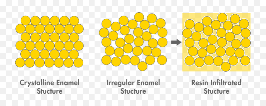 Enamel White Patches - Horizontal Png,Icon White Spot Removal