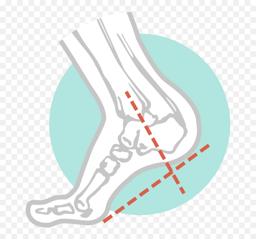 Circulatory Assessments Diabetic Feet U2014 The Perth Png Blood Circulation Icon