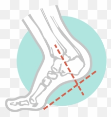 Circulatory Assessments Diabetic Feet U2014 The Perth Png