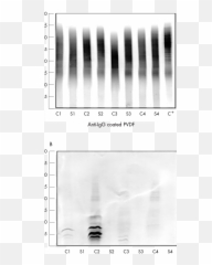 Immunoblots Of Igg A And Free Kappa Bands B From Four - Monochrome Png,Kappa Png