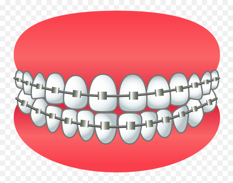 Dental Braces Clipart Free Download Transparent Png - Transparent Braces Clipart,Braces Png