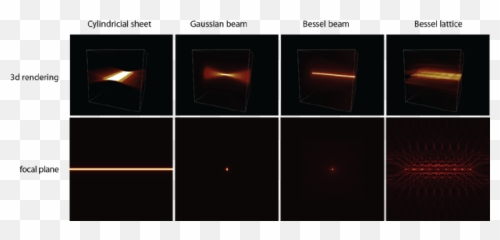 Cat Eye Syndrome Chromosome Region 1 Cecr1 Gene And - png