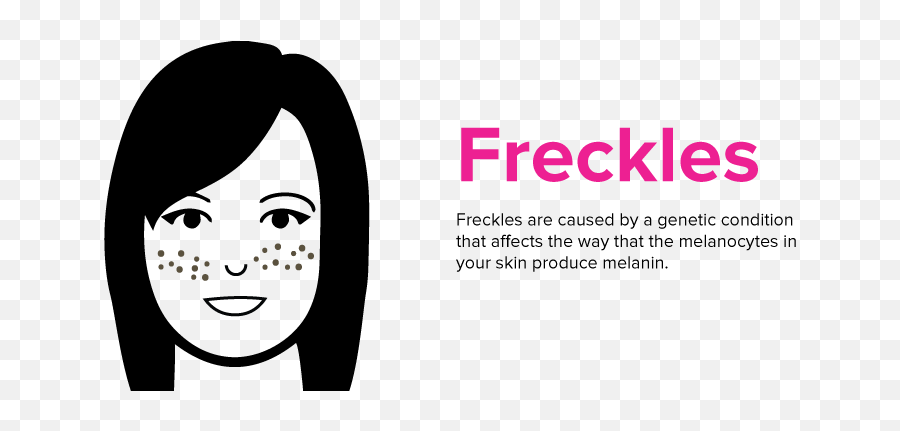 Freckles Png - Cartoon,Freckles Png