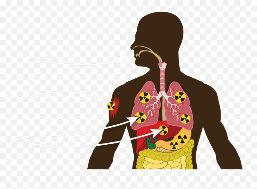 Radiation Contamination Versus Exposure Chemicals - Contamination Radiation Png,Person Infographic Icon