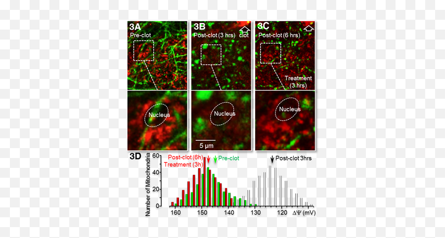 Improving Brain Cell Function - Astrocyte Pharmaceuticals Graphic Design Png,Mitochondria Png