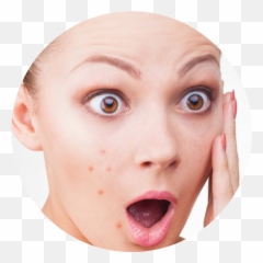 Acne Face Cure Skin Boil Care Clipart - Acne Face Png,Pimple Png