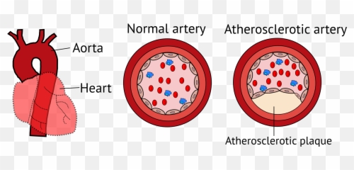 Dental Plaque Itinerary Blood Vessels Unraveling The - Circle Png,Blood Cut Png