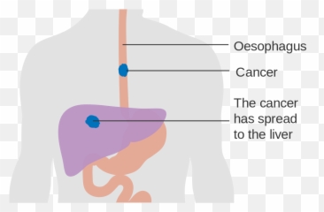 Lower Third Esophagus Png U0026 Free Esophaguspng - Oesophagus Diagram