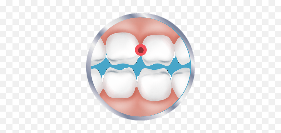 Is It A Cavity Or Sensitive Teeth - Bracket Png,Aniami Teeth Icon