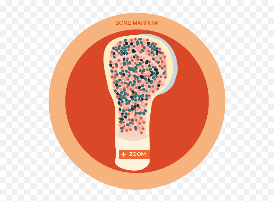 What Is Chronic Lymphocytic Leukemia Cll Or Small - Light Bulb Png,Red Lighbulb Icon