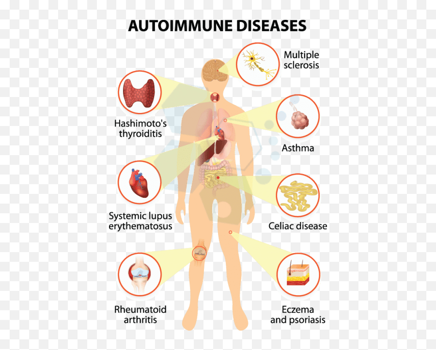Lupus Causes Types Symptoms U0026 Treatments - Specialty Autoimmune Lupus Disease Png,Lupus Icon