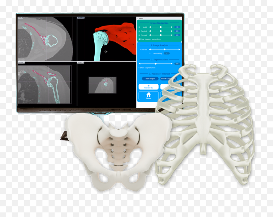 Rhino3dmedical U2013 The Fastest Way From Medical Images To Cad - Skull Png,3d Skull Png