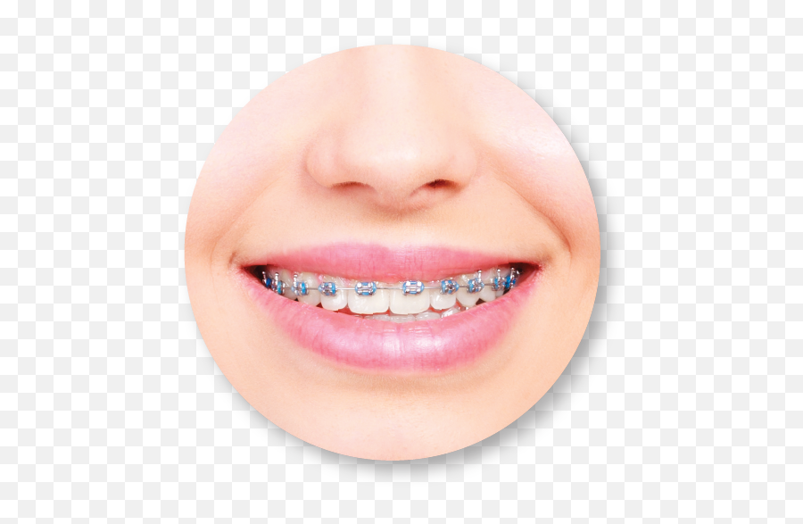 Dr Isaak Yelizar Orthodontist In Rego Park Ny - Dental Braces Png,Braces Png