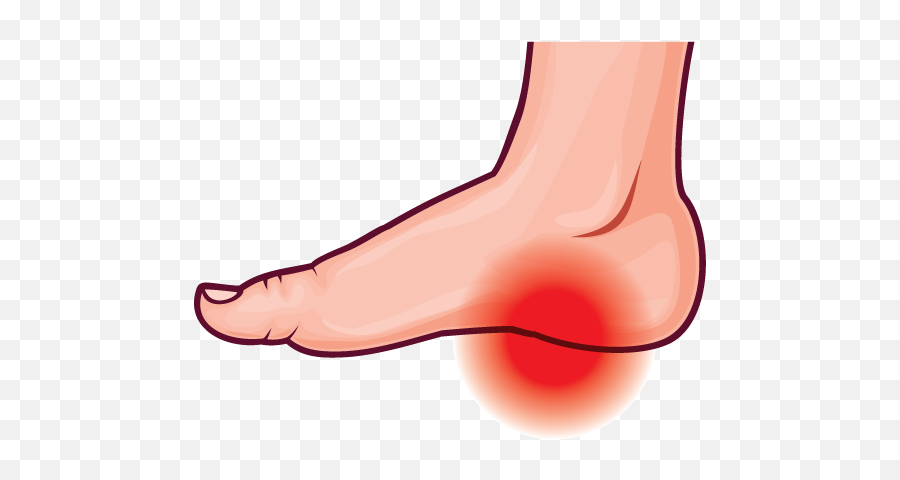Feet Clipart Ankle - Foot Pain Clipart Png Download Full Clip Art,Feet Png