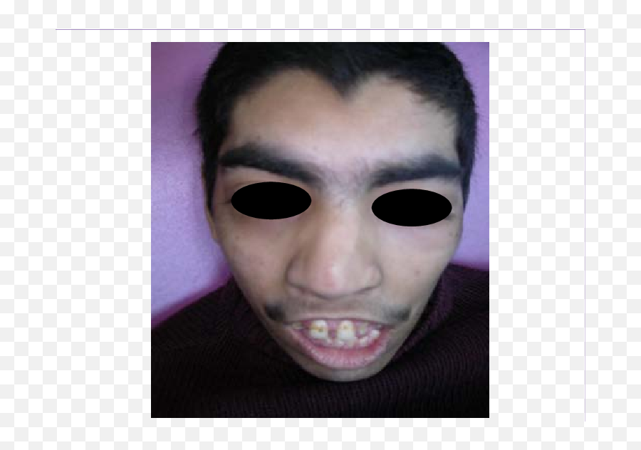 Unibrow Transparent Png Image - For Adult,Unibrow Png
