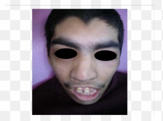 Unibrow Transparent Png Image - For Adult,Unibrow Png
